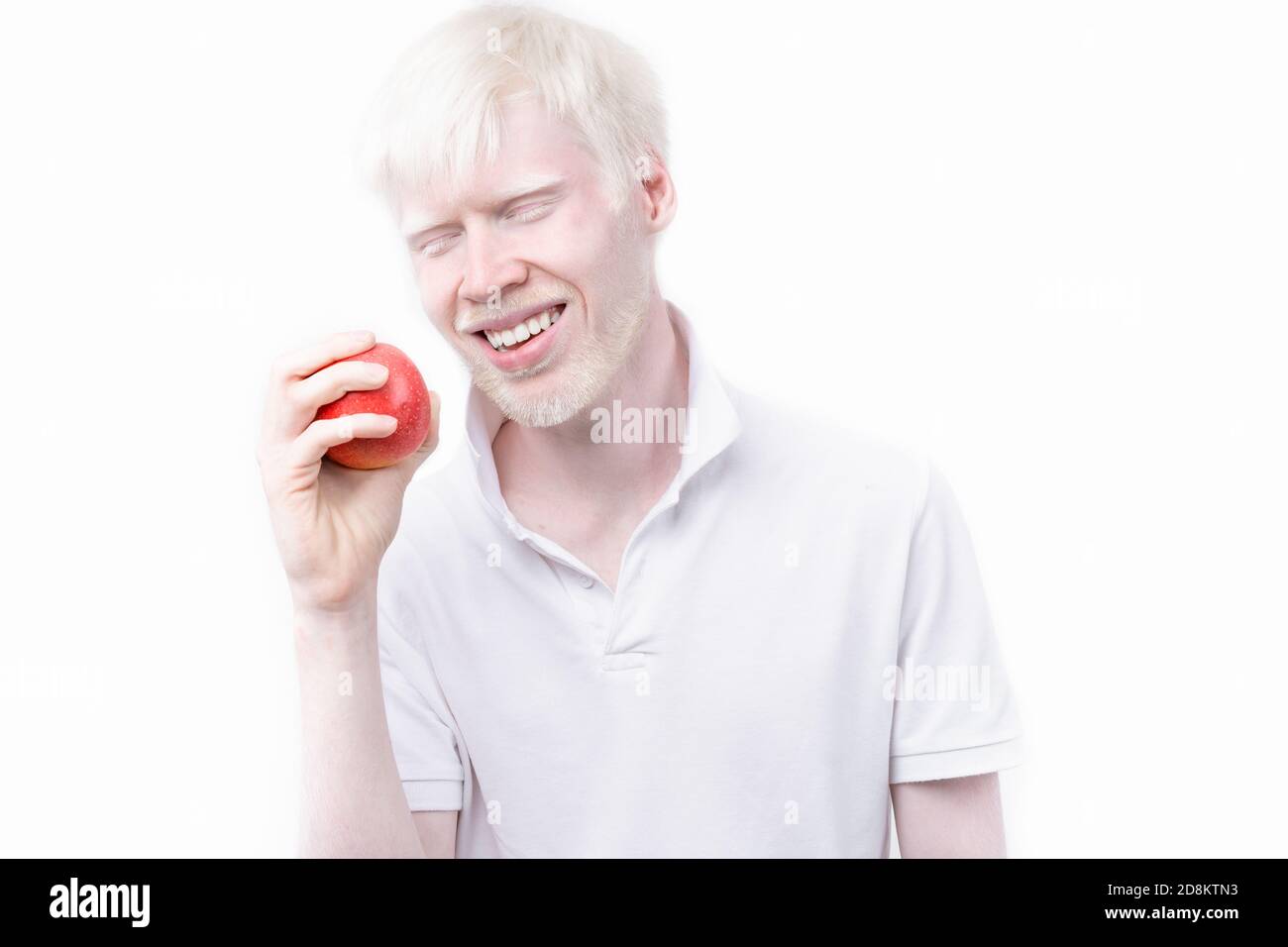 Albinisme albino homme peau blanche cheveux studio habillé t-shirt isolé fond blanc. Anomalies. Aspect inhabituel. Anomalie de la peau Beauti Banque D'Images