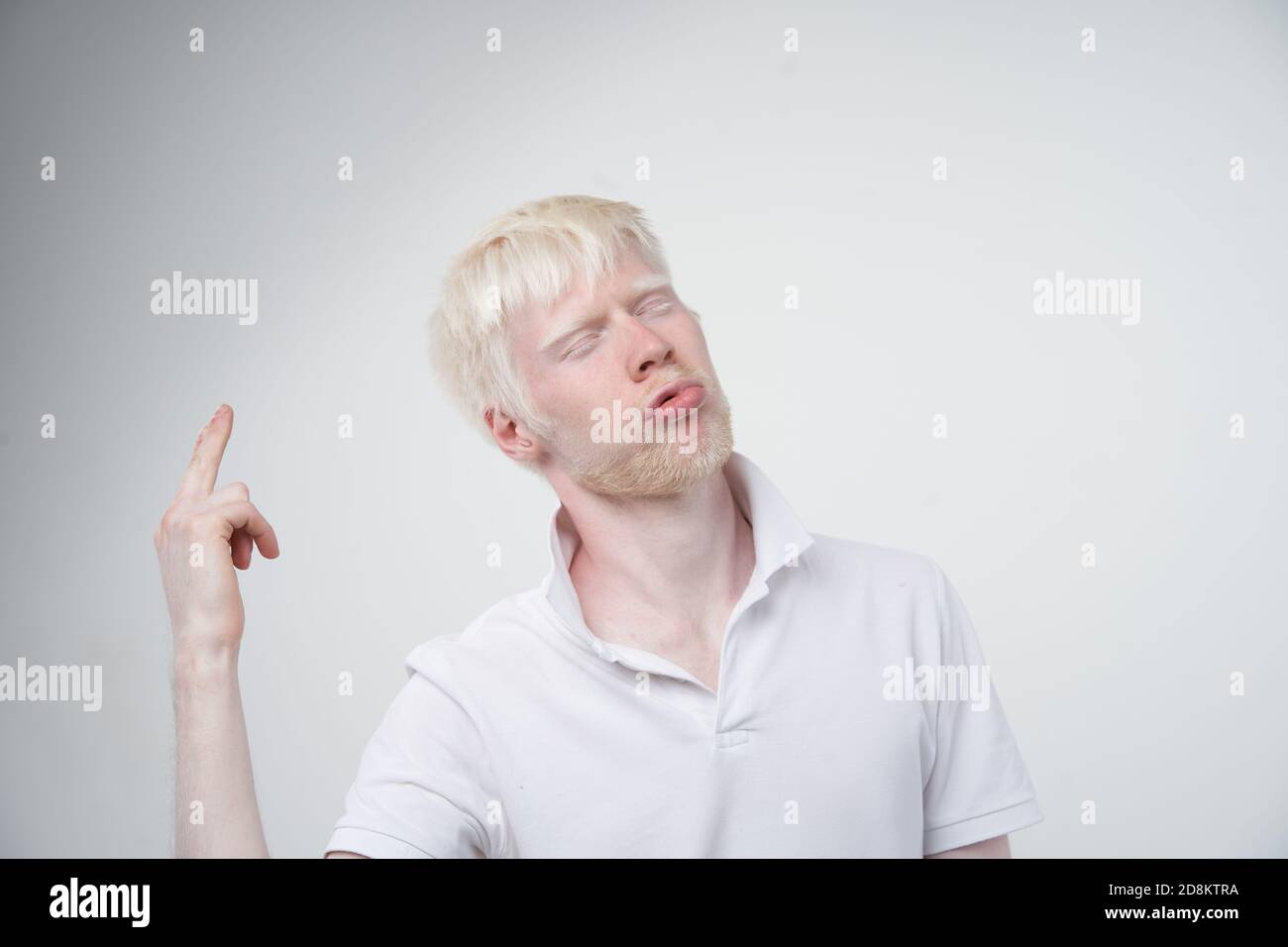 Triste albino homme peau blanche cheveux studio habillé t-shirt isolé fond blanc. Anomalies. Aspect inhabituel. Anomalie de la peau beau p Banque D'Images