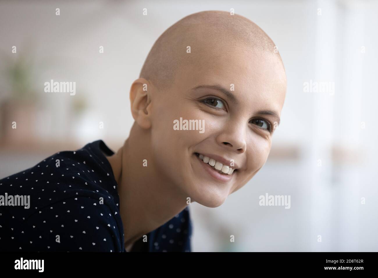 Tête portrait surjoyeuse femme sans cheveux regardant l'appareil photo Banque D'Images