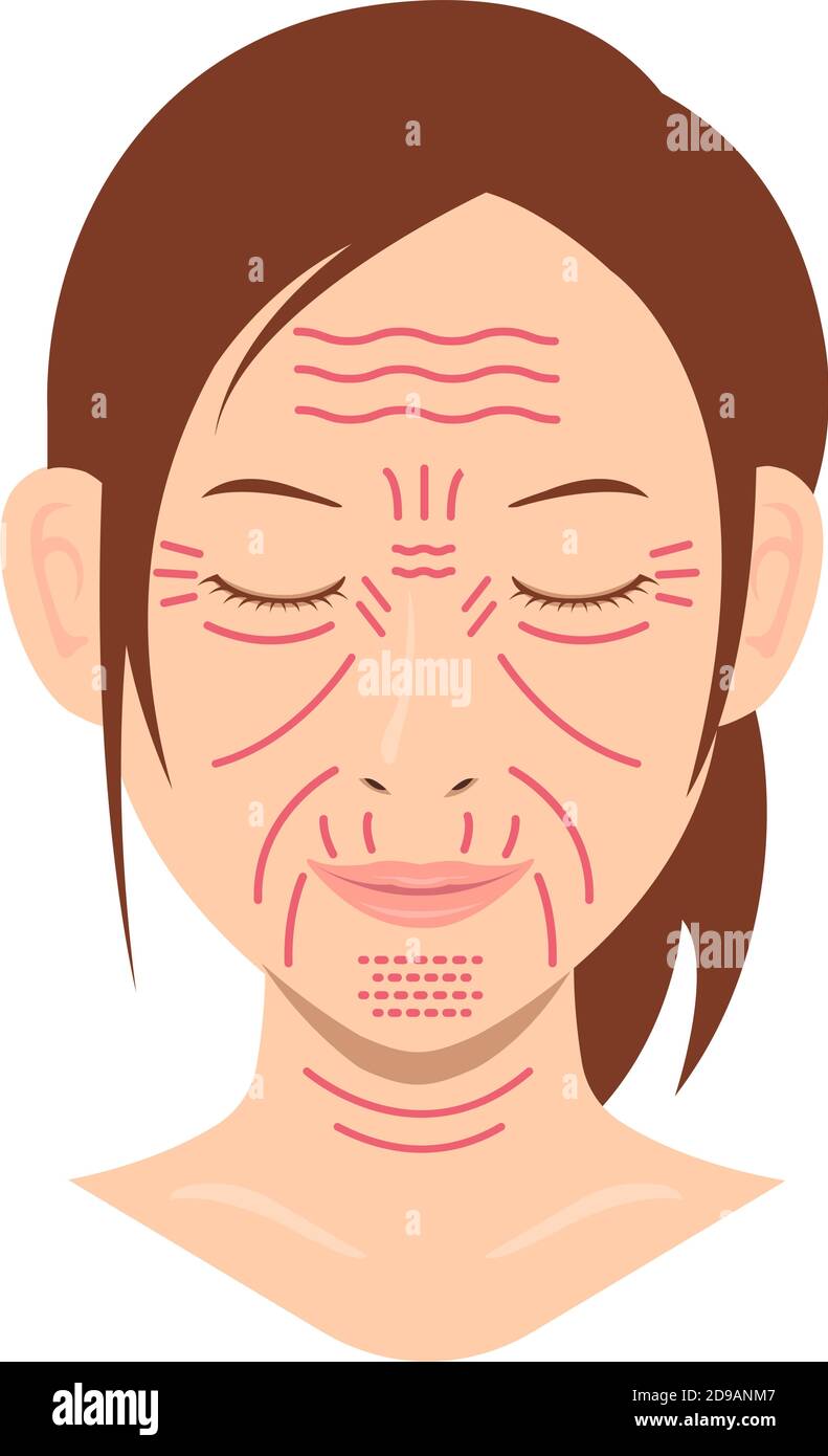 Rides faciales ( visage féminin ) illustration vectorielle / pas de texte Illustration de Vecteur