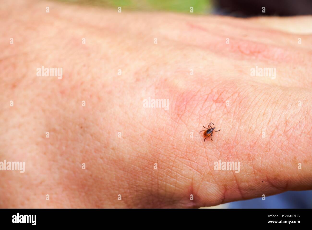 Tique à échelle, acarien dur de la famille Ixodidae sur la main humaine. Il porte des agents pathogènes qui peuvent causer des maladies humaines. Banque D'Images