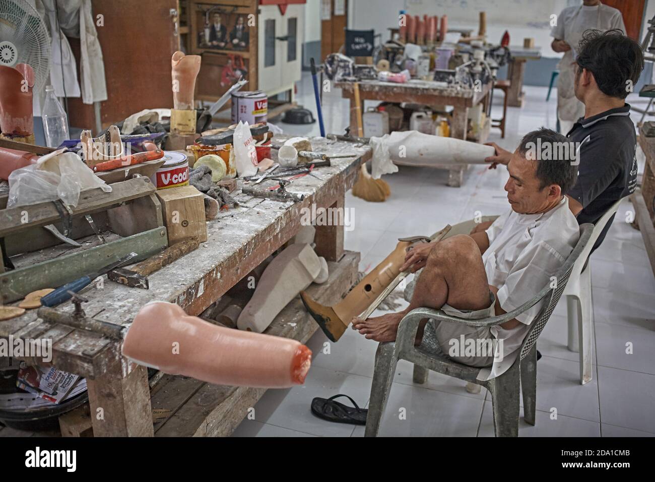 Mae SOT, Thaïlande. Avril 2012. Atelier de prothèse pour les victimes de mines terrestres à la clinique de Mae Tao qui fournit une assistance médicale aux réfugiés du Myanmar. Banque D'Images