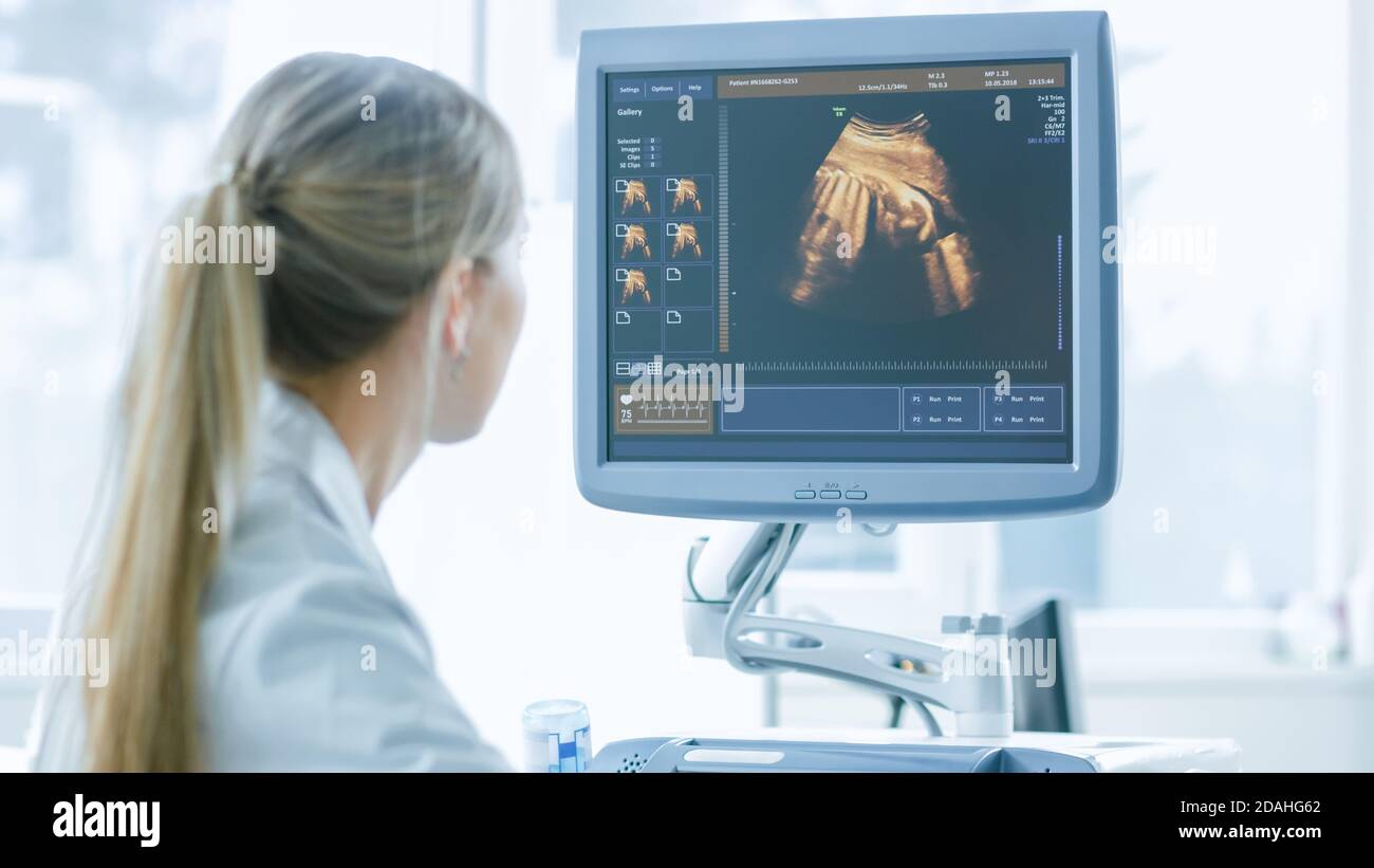 À l'hôpital, l'obstétricien utilise le transducteur pour l'échographie de dépistage de l'échogramme Belly de la femme enceinte. L'écran de l'ordinateur affiche l'image 3D Banque D'Images