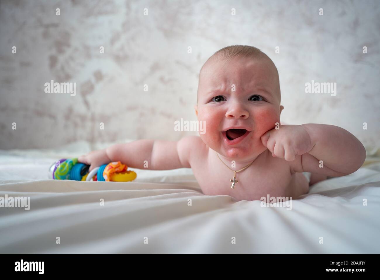 Gros plan d'un bébé avec allergie cutanée couché sur le lit. Gros plan du  visage d'un bébé avec allergie cutanée. Le bébé pleure Photo Stock - Alamy