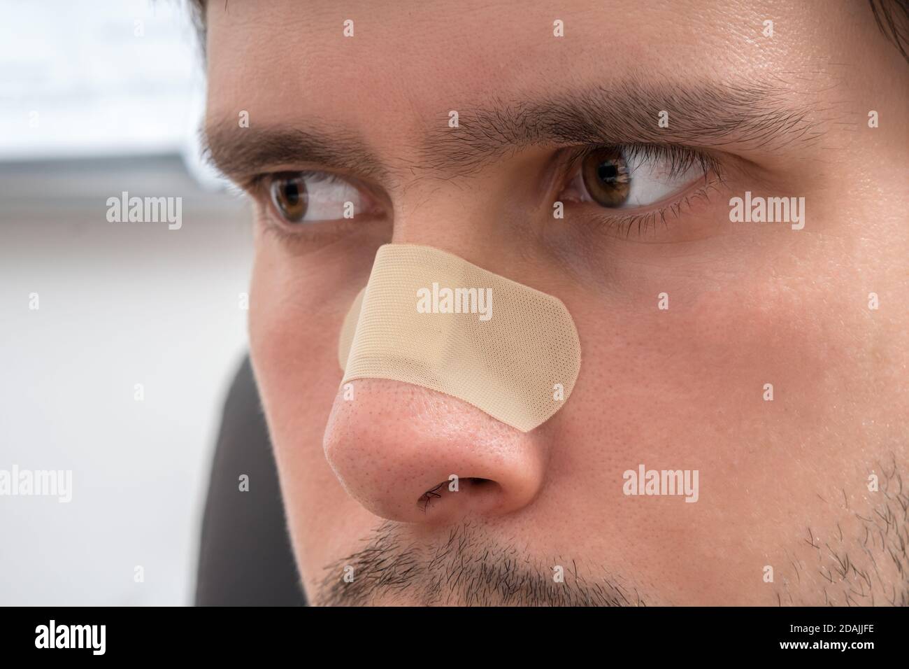 Le jeune homme blessé a du plâtre sur son nez. Banque D'Images