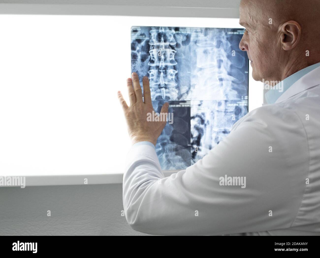 Médecin examinant les patients radiographies du rachis et IRM. Diagnostic des maladies de la colonne vertébrale, des blessures du dos et de la colonne cervicale Banque D'Images