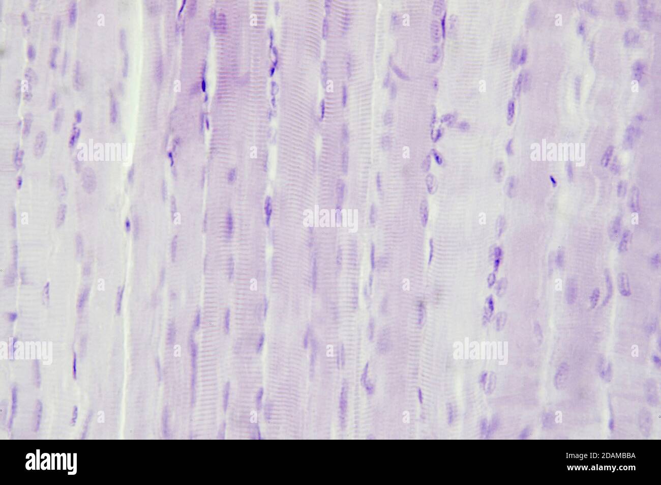 Muscle squelettique, micrographe léger. Banque D'Images