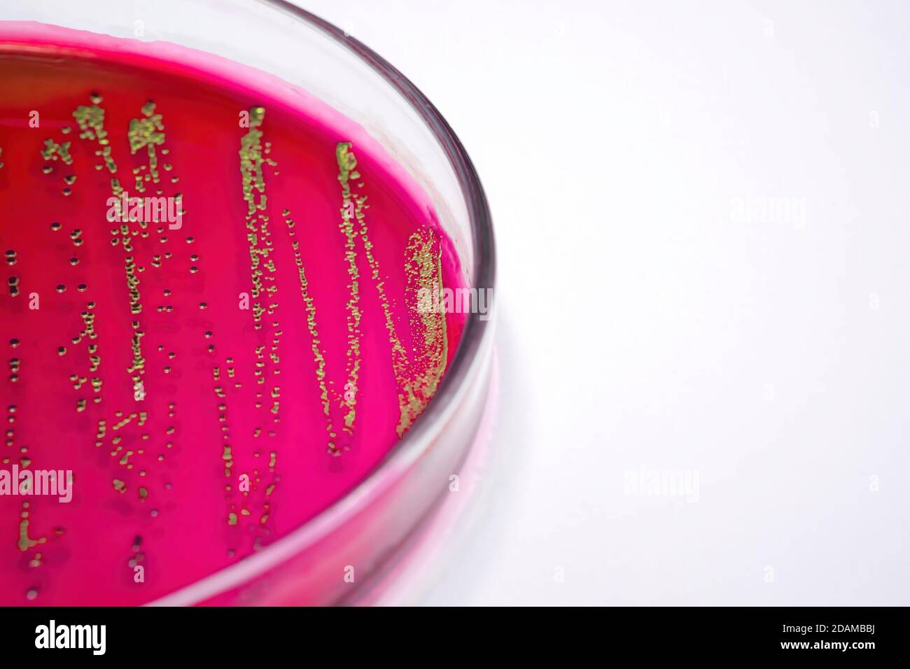 Escherichia coli sur milieu sélectif de gélose au sang. Banque D'Images