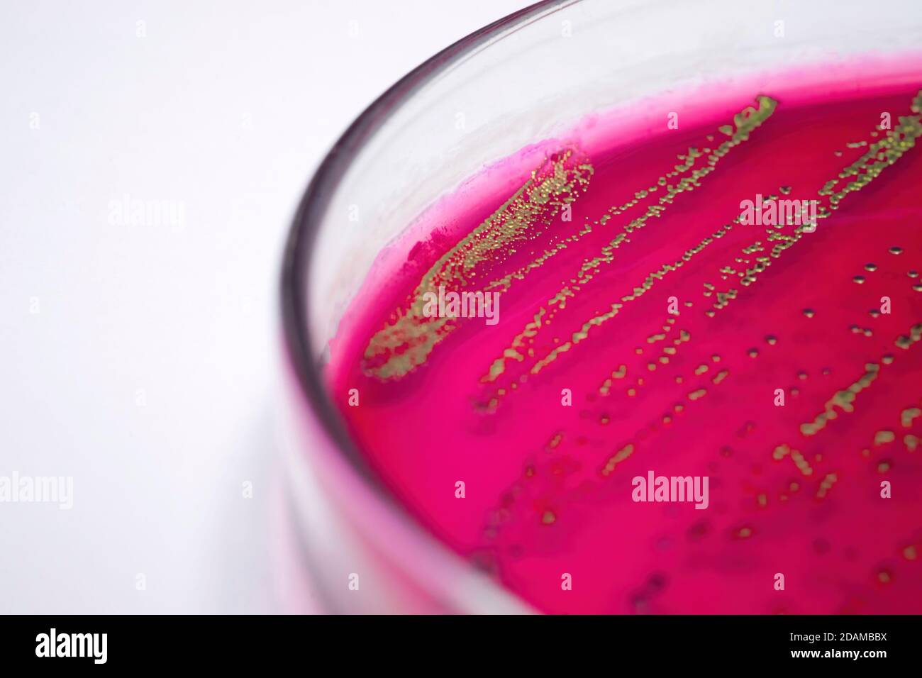 Escherichia coli sur milieu sélectif de gélose au sang. Banque D'Images