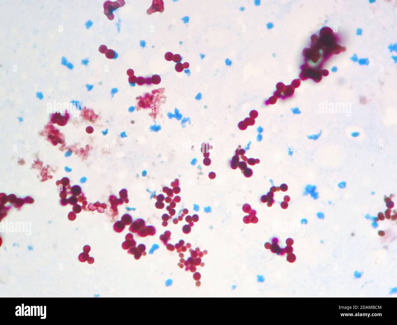 Bactéries Mycobacterium marinum, micrographe léger. Mycobacterium marinum est un pathogène opportuniste des poissons d'eau douce et marins. Il provoque necrotiz Banque D'Images