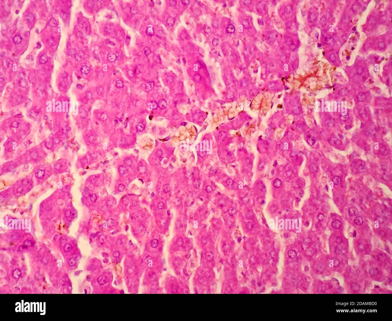 Liver tissue Banque de photographies et d’images à haute résolution - Alamy