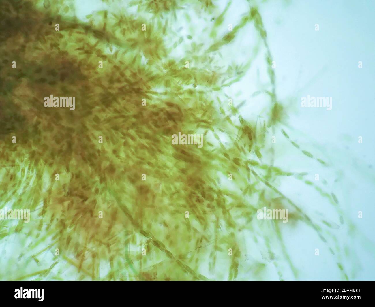 Algues filamenteuses, micrographe léger. Les algues filamenteuses sont des cellules d'algues simples qui forment de longues chaînes, fils ou filaments visibles. Banque D'Images
