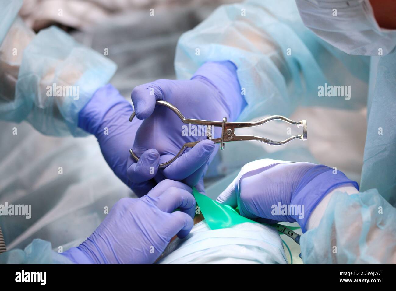 Retrait de caries sous anesthésie générale chez un enfant. Les mains d'un dentiste dans des gants.espace de copie.une photo méconnaissable. Banque D'Images