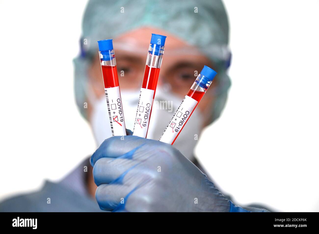 Résultat positif du test, personnel médical utilisant la RT-PCR, réaction en chaîne de la polymérase transcriptase inverse en temps réel, test de corona, crise de corona Banque D'Images