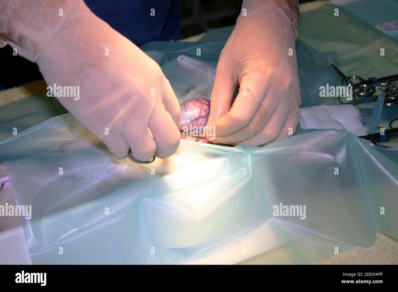 Les mains d'un chirurgien qualifié pour effectuer une chirurgie délicate Banque D'Images