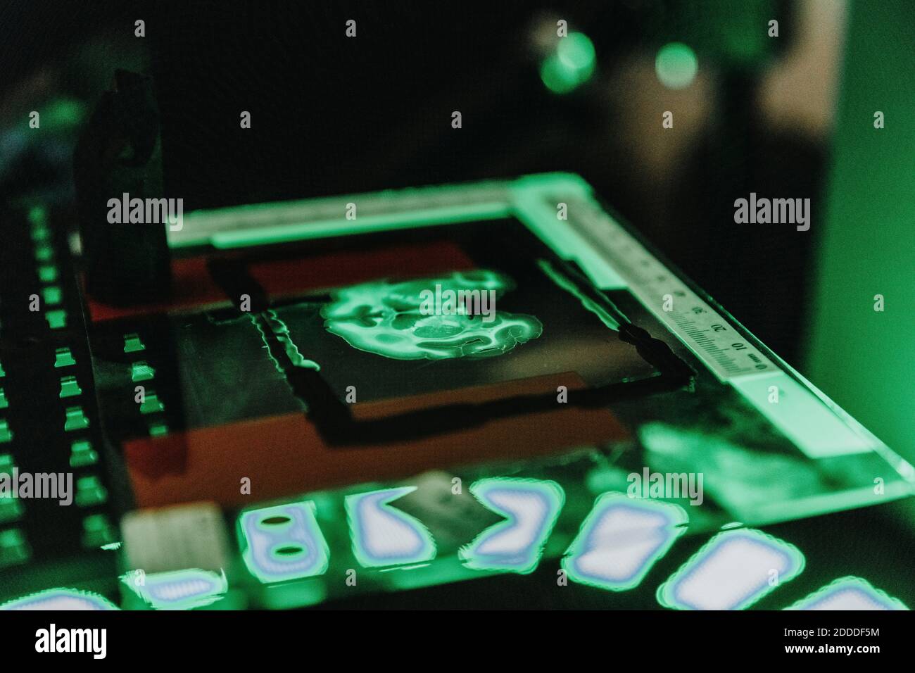 Lame de cerveau humain au microscope en laboratoire Banque D'Images