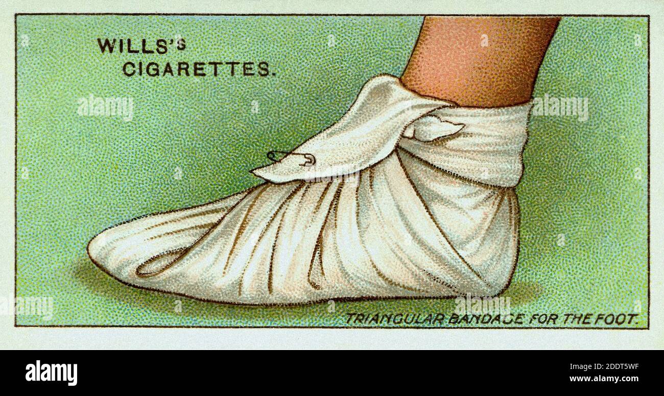 Cartes de cigarettes anciennes. Cigarettes de testament (série premiers soins ). Bandage triangulaire pour le pied. Angleterre. 1913 Banque D'Images