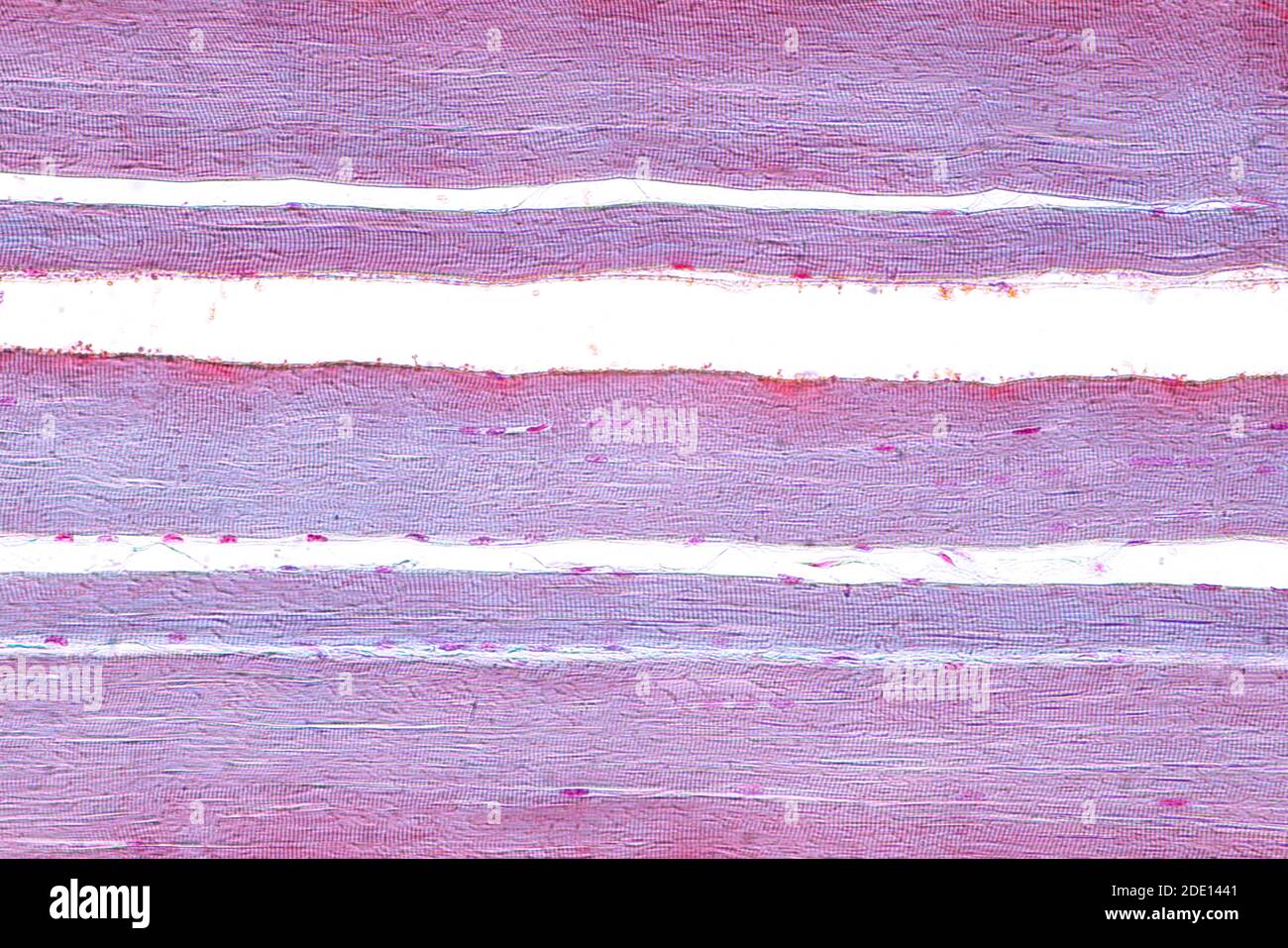 Muscle squelettique humain, micrographe léger Banque D'Images