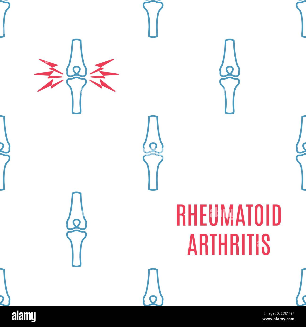 Polyarthrite rhumatoïde, illustration conceptuelle Banque D'Images