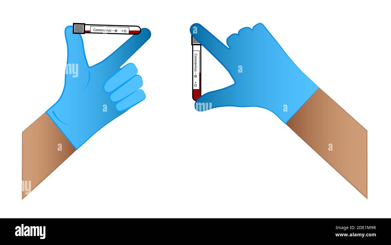 les médecins ont la main dans un gant pour tenir des tubes à essai avec des tests de coronavirus. Résultat positif et négatif. Vecteur isolé sur fond blanc Illustration de Vecteur