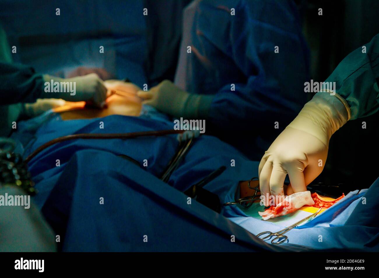L'opération chirurgicale de jambe en utilisant différents outils chirurgicaux au cours de la salle d'opération à l'hôpital. Banque D'Images