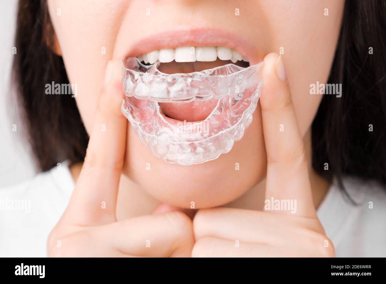 Femme souriante avec des dents parfaites et saines utilisant des bretelles amovibles ou un outil d'alignement pour lisser et blanchir les dents. Traitement orthodontique pour Banque D'Images