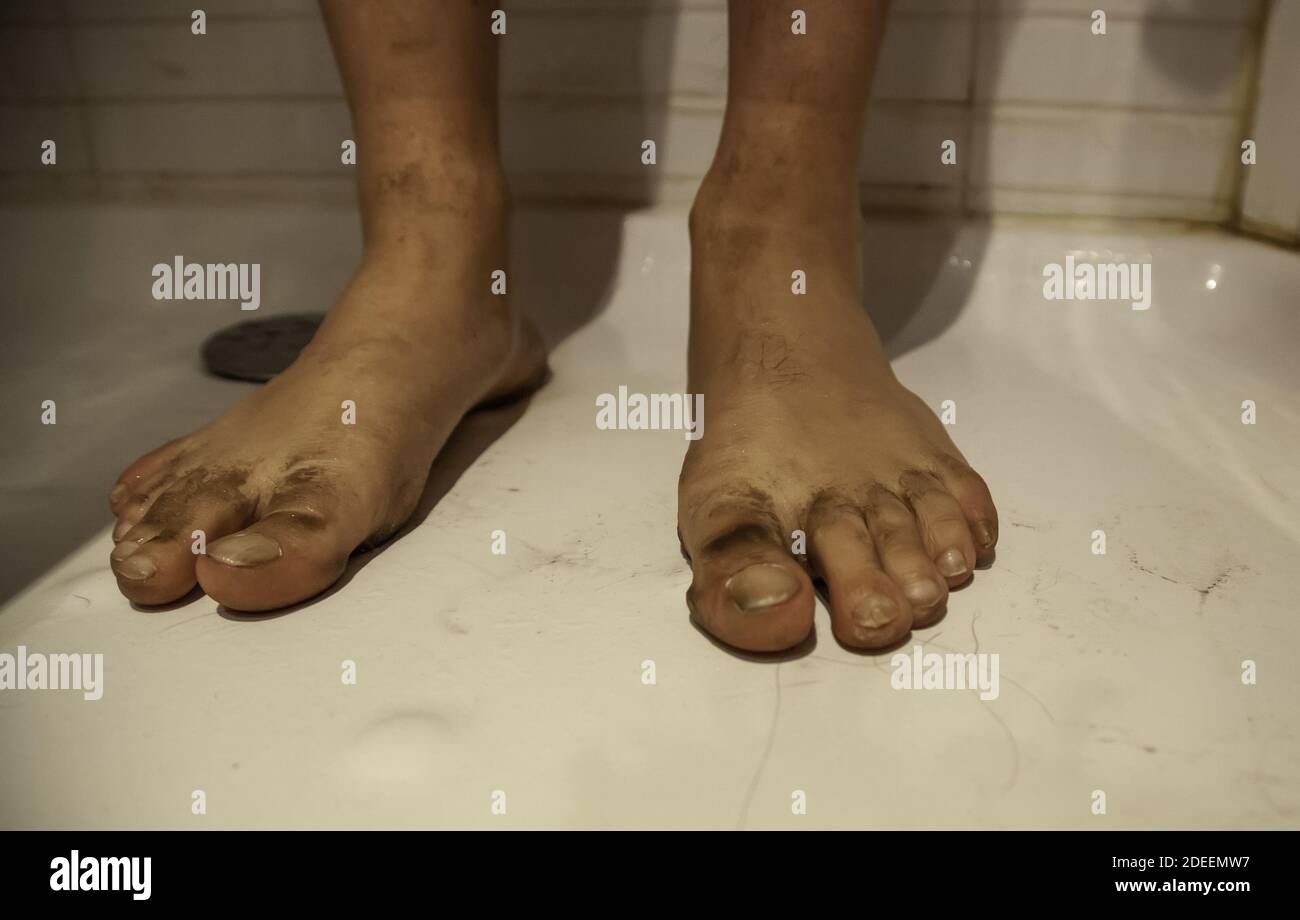 Nettoyage des pieds sales et noirs sous la douche, désinfection et hygiène  personnelle Photo Stock - Alamy