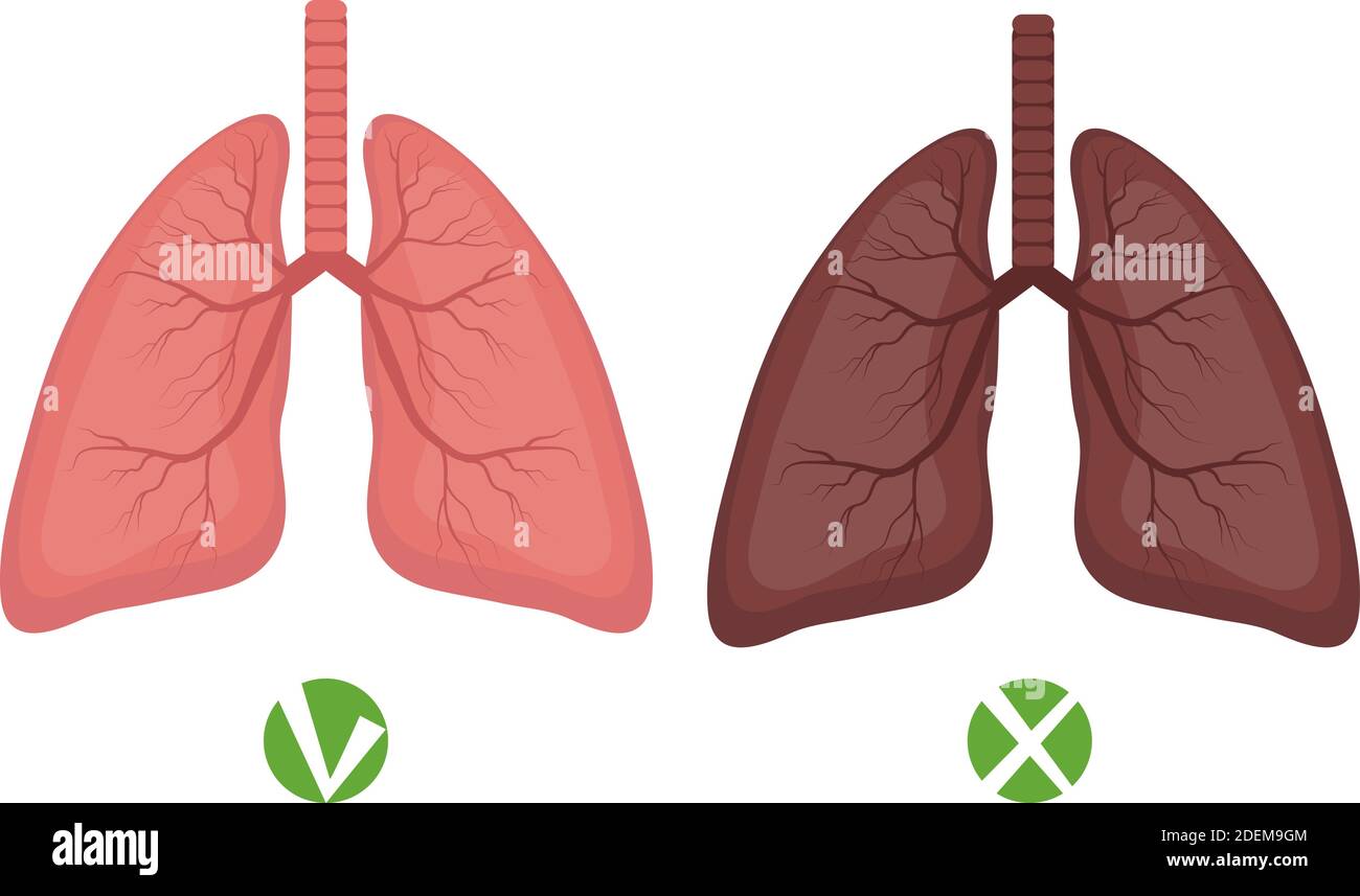 Maladies des poumons et des poumons en santé ou infographies des fumeurs isolées sur fond blanc