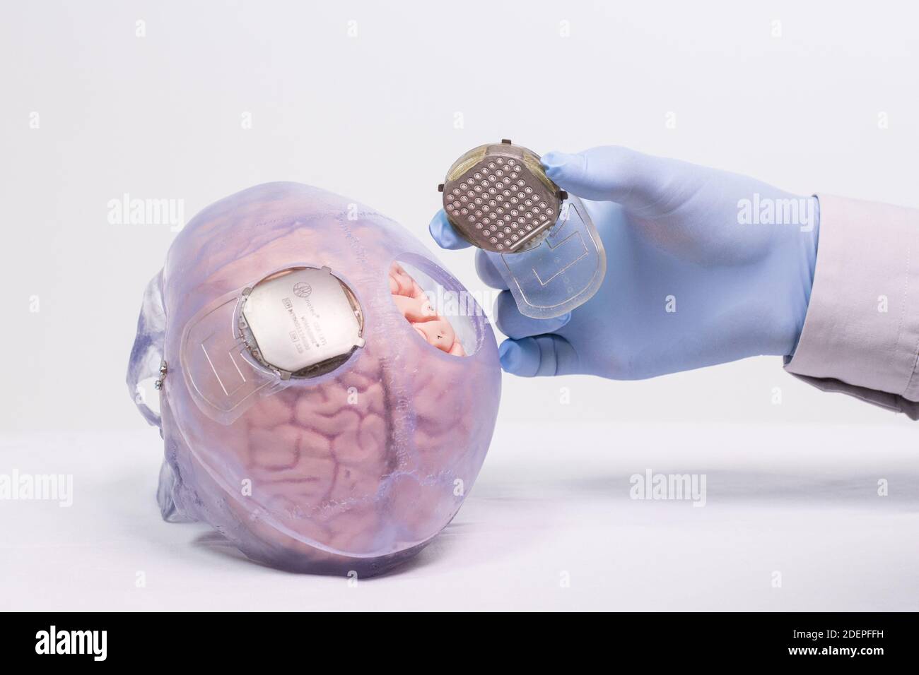 Cette PHOTOGRAPHIE DISTRIBUÉE par Clinatec Endowment Fund (fonds de dotation Clinatec) le 4 octobre 2019 montre des scientifiques français porteurs d'un implant qui est tétraplégique « Thibault » qui utilise un exo-squelette (exosquelette), a entre le cerveau et la peau qui lit la zone du cerveau qui contrôle le mouvement, À l'Université de Grenoble. Paralysé depuis l'automne il y a quatre ans, 'Thibault' parvient maintenant à diriger les mouvements d'un exosquelette par la pensée, une sorte d'armure motorisée. Une première par des chercheurs français, qui ouvre des perspectives importantes pour la paraplégie. Photo fournie par la Breche Banque D'Images