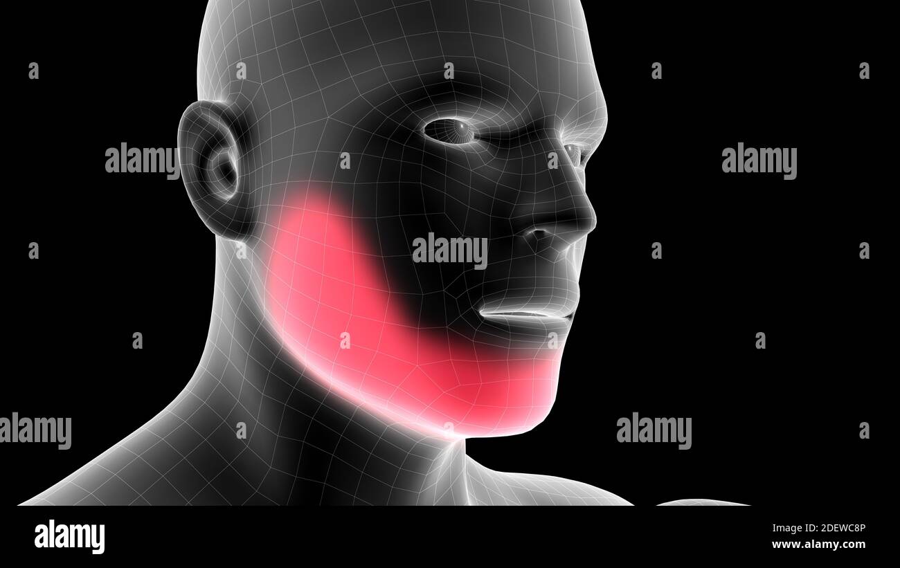 illustration 3d d'un hologramme à rayons x pour hommes montrant la zone de douleur sur la tête Banque D'Images