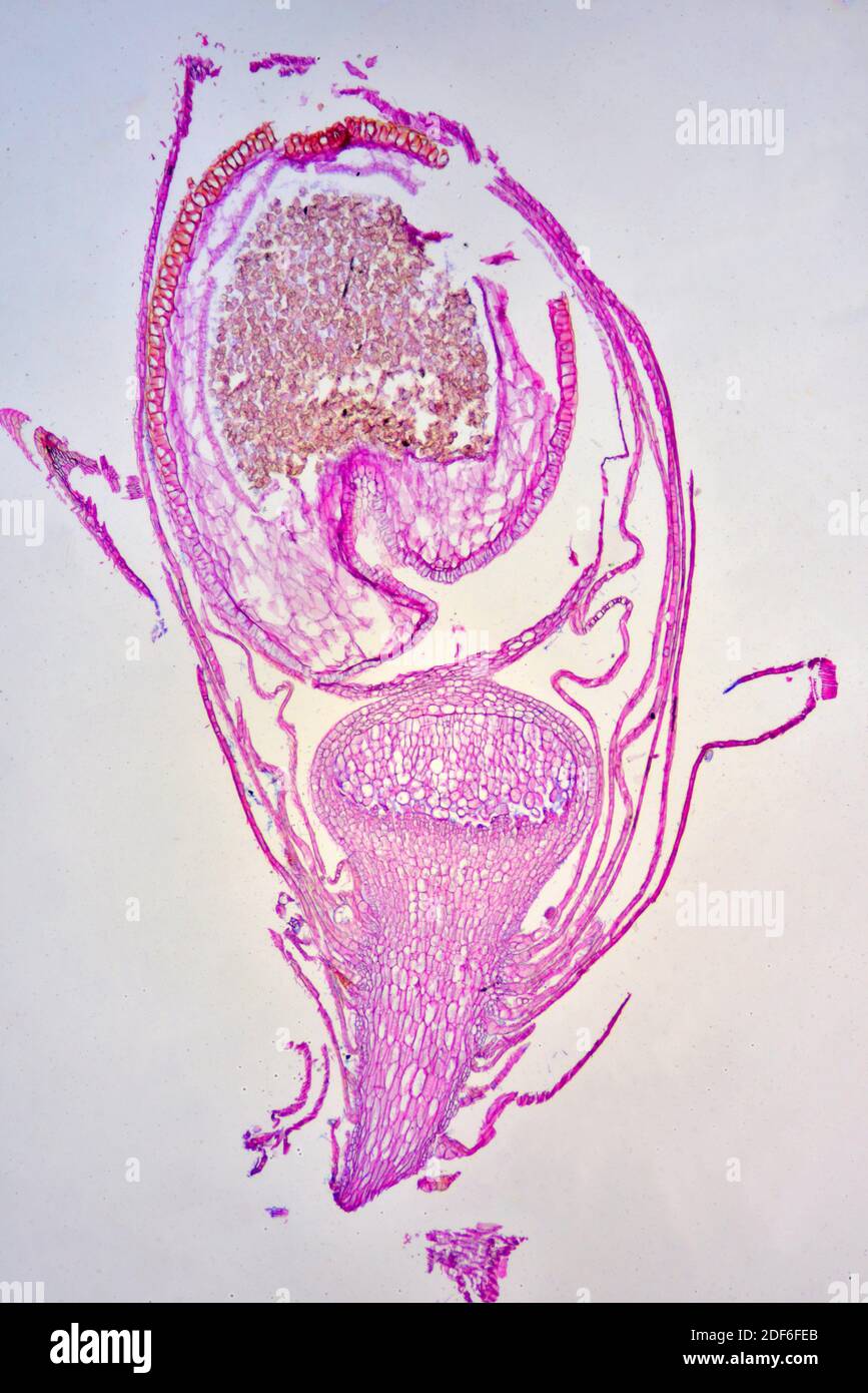 Sphagnum sporophyte, capsule et spores. Microscope optique X40. Banque D'Images