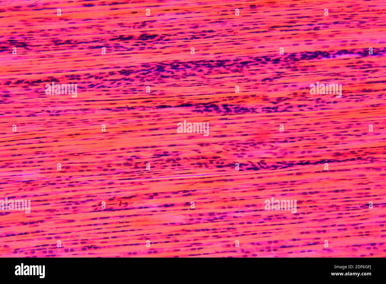 Tissu conjonctif dense ou tissu fibreux dense présentant des fibroblastes,  des fibres de collagène et une matrice. Microscope optique X200 Photo Stock  - Alamy