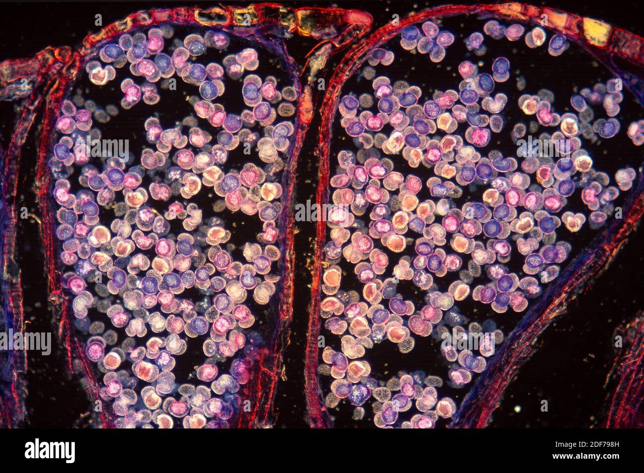 Cône de pin mâle montrant du pollen. Photomicrographe. Banque D'Images