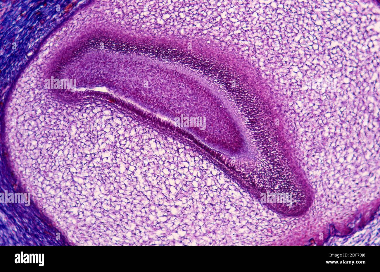 Tissu osseux sur dent embryonnaire humaine. Photomicrographe. Banque D'Images