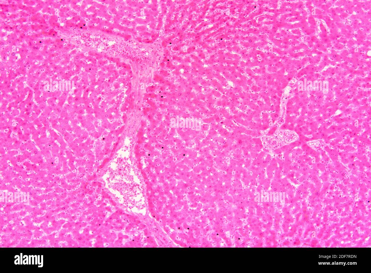 Foie humain avec hépatocytes et vaisseau sanguin. X75 à 10 cm de ...