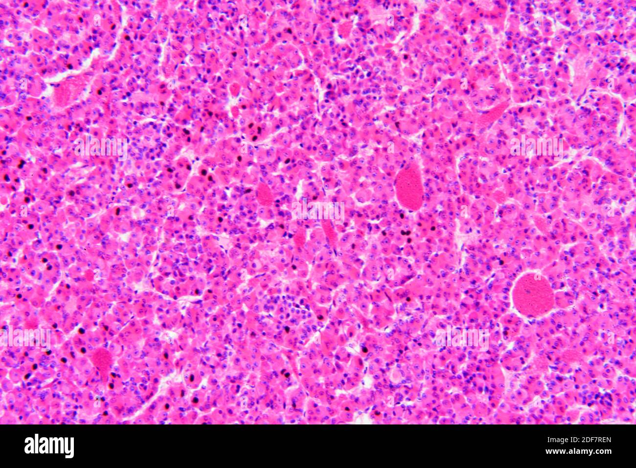 Hypophyse humaine ou glande pituitaire. X125 à 10 cm de large. Banque D'Images