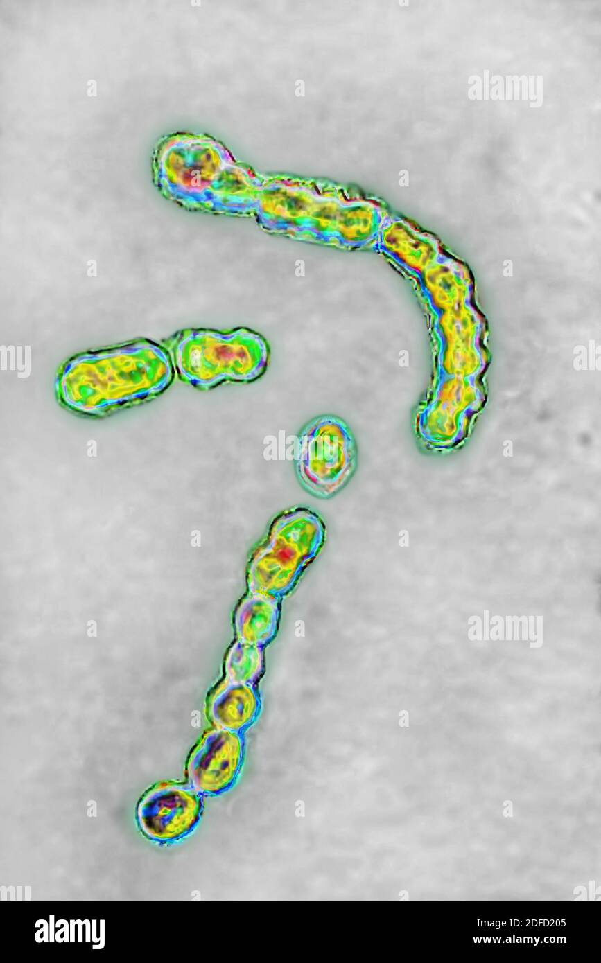 Streptococcus pyogenes Banque D'Images Streptococcus pyogenes Banque D'Images