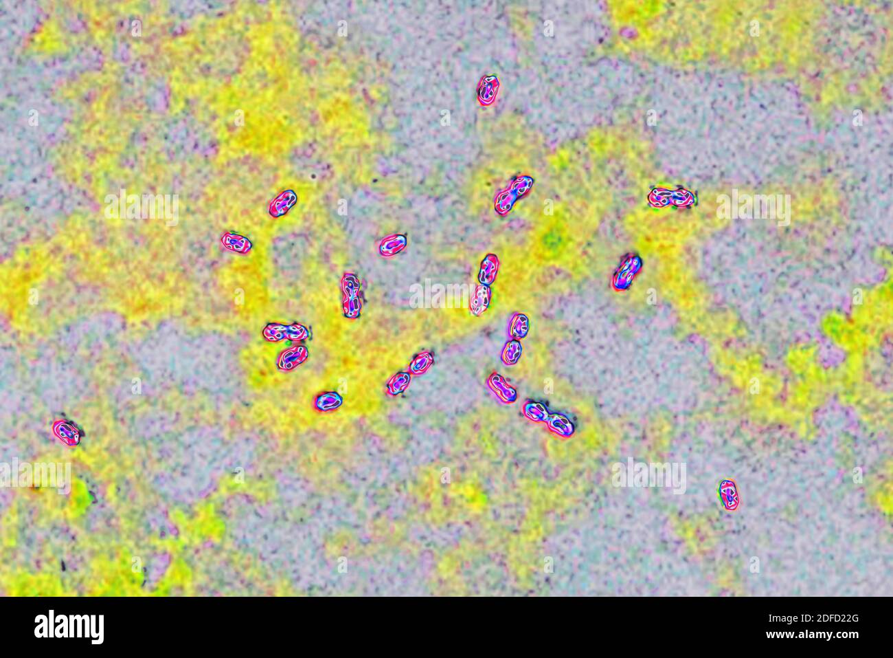 Bactéries pneumococciques Banque D'Images
