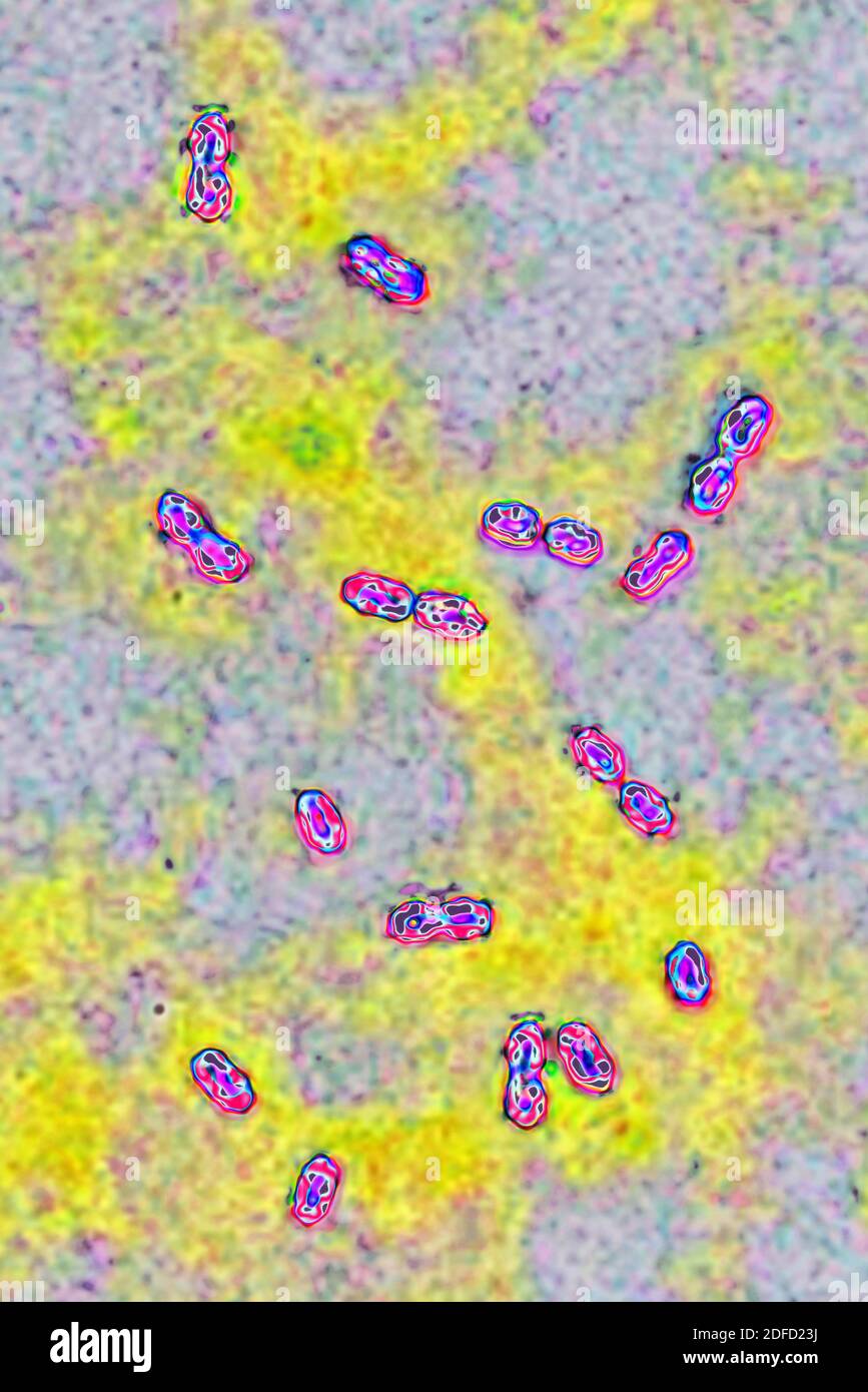 Bactéries pneumococciques Banque D'Images