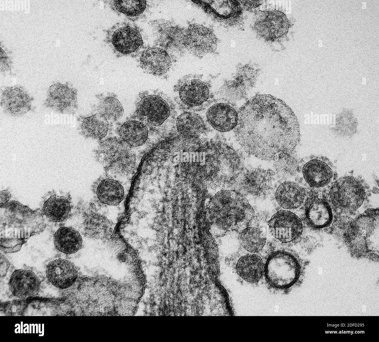 Particules du coronavirus mers Banque D'Images