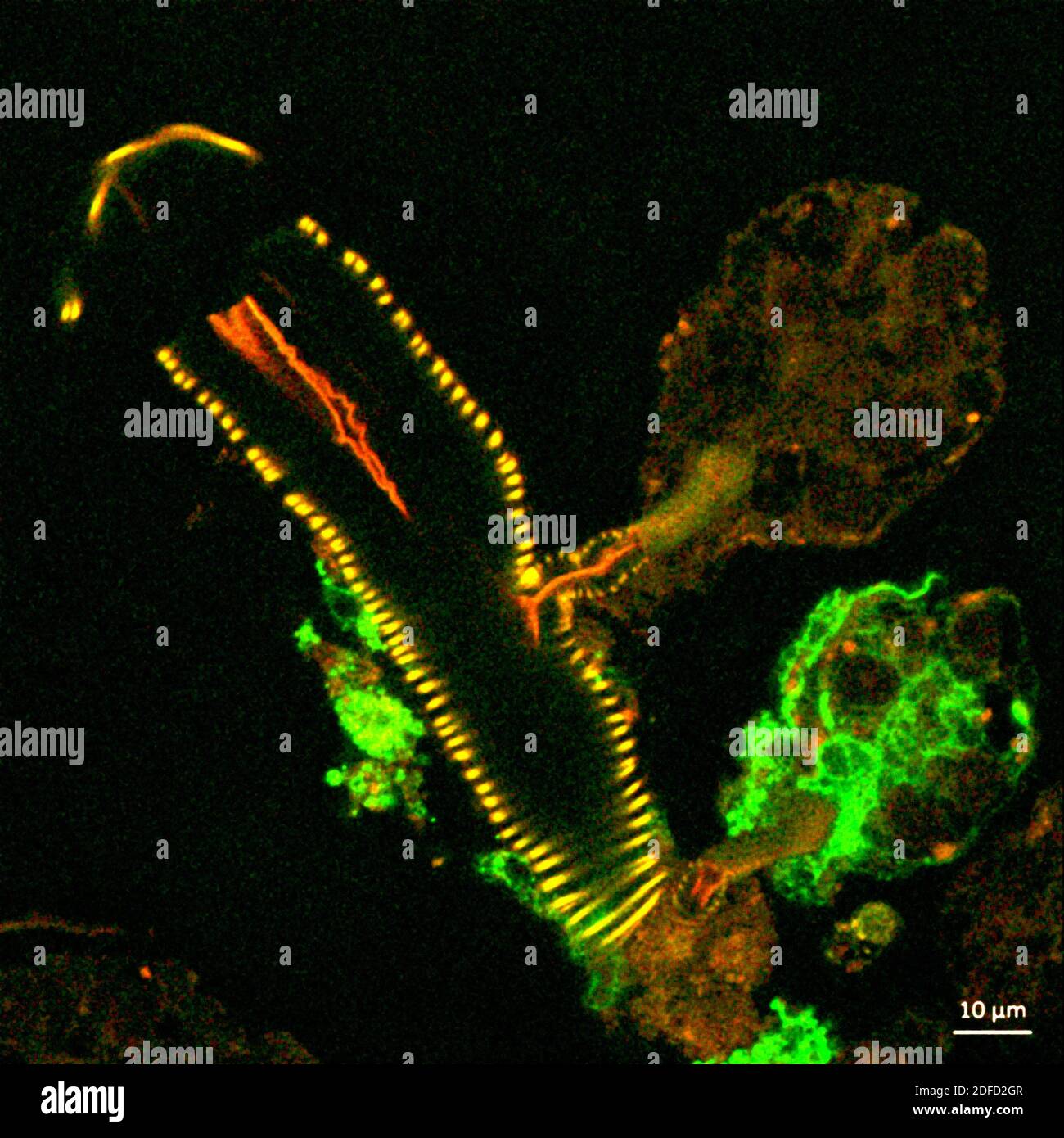 Cette image confocale au microscope montre une coupe transversale d'une glande salivaire de tique infectée par le virus Langat (vert). Deux structures arrondies à droite, Banque D'Images