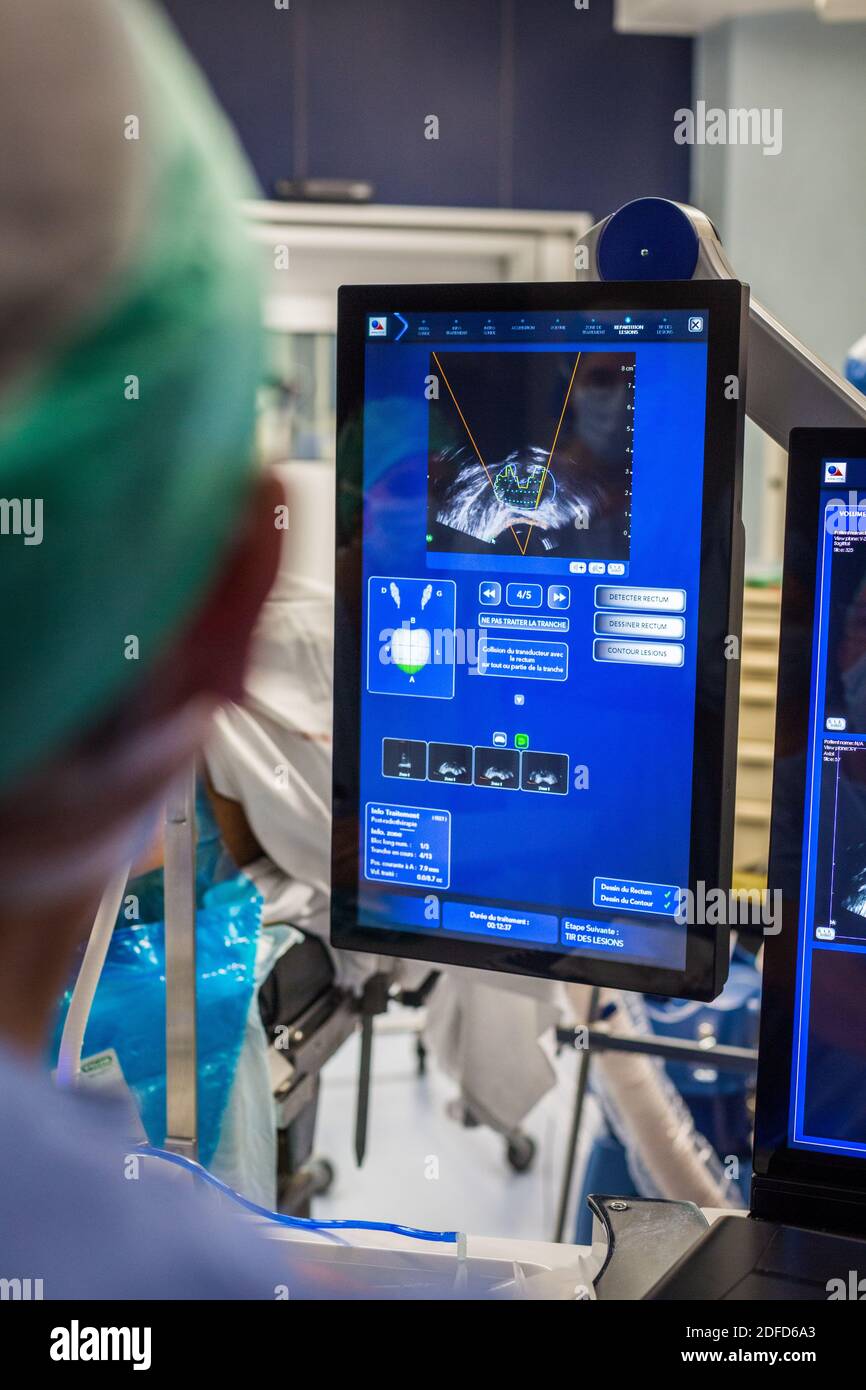 Traitement du cancer prostatique par ultrasons focalisés à haute intensité (focal-One), hôpital de Bordeaux, France. Banque D'Images