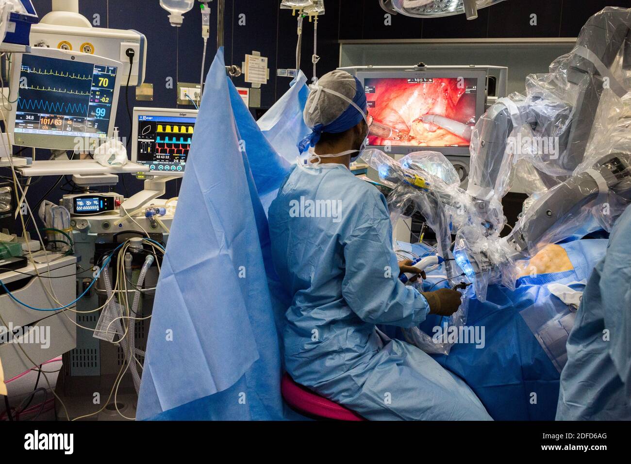 Prostatectomie réalisée par le robot de la téléchirurgie, hôpital de Bordeaux, France. Banque D'Images