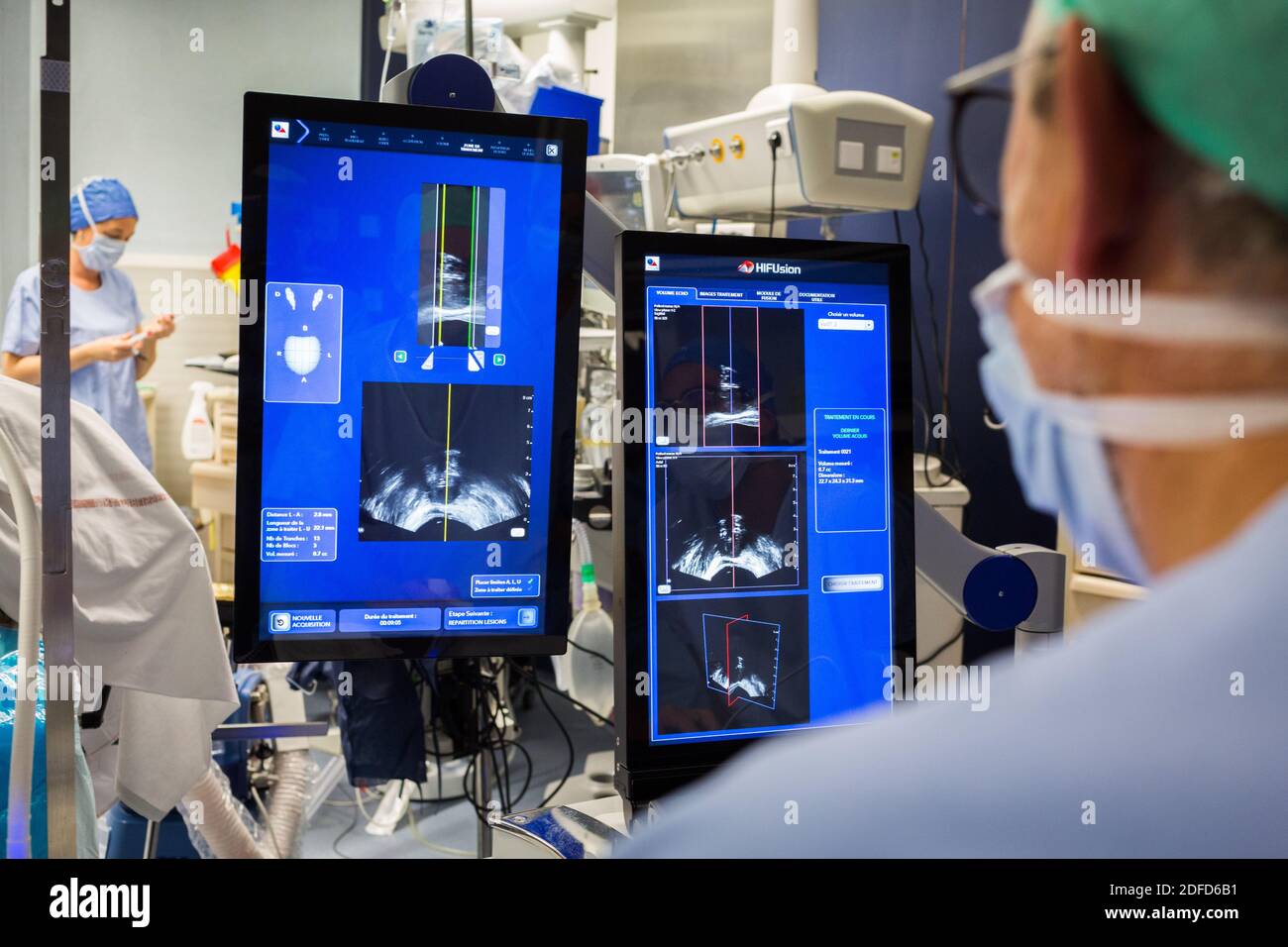 Traitement du cancer prostatique par ultrasons focalisés à haute intensité (focal-One), hôpital de Bordeaux, France. Banque D'Images