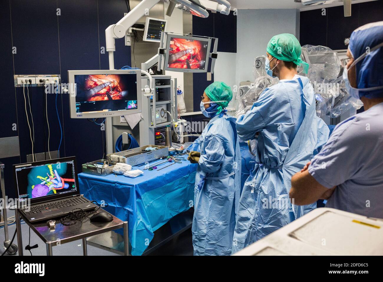 La chirurgie rénale conservatrice robotique guidée par l'image assistée par la modélisation 3D, cette modélisation 3D du rein avec sa tumeur située en violet, guide les s. Banque D'Images