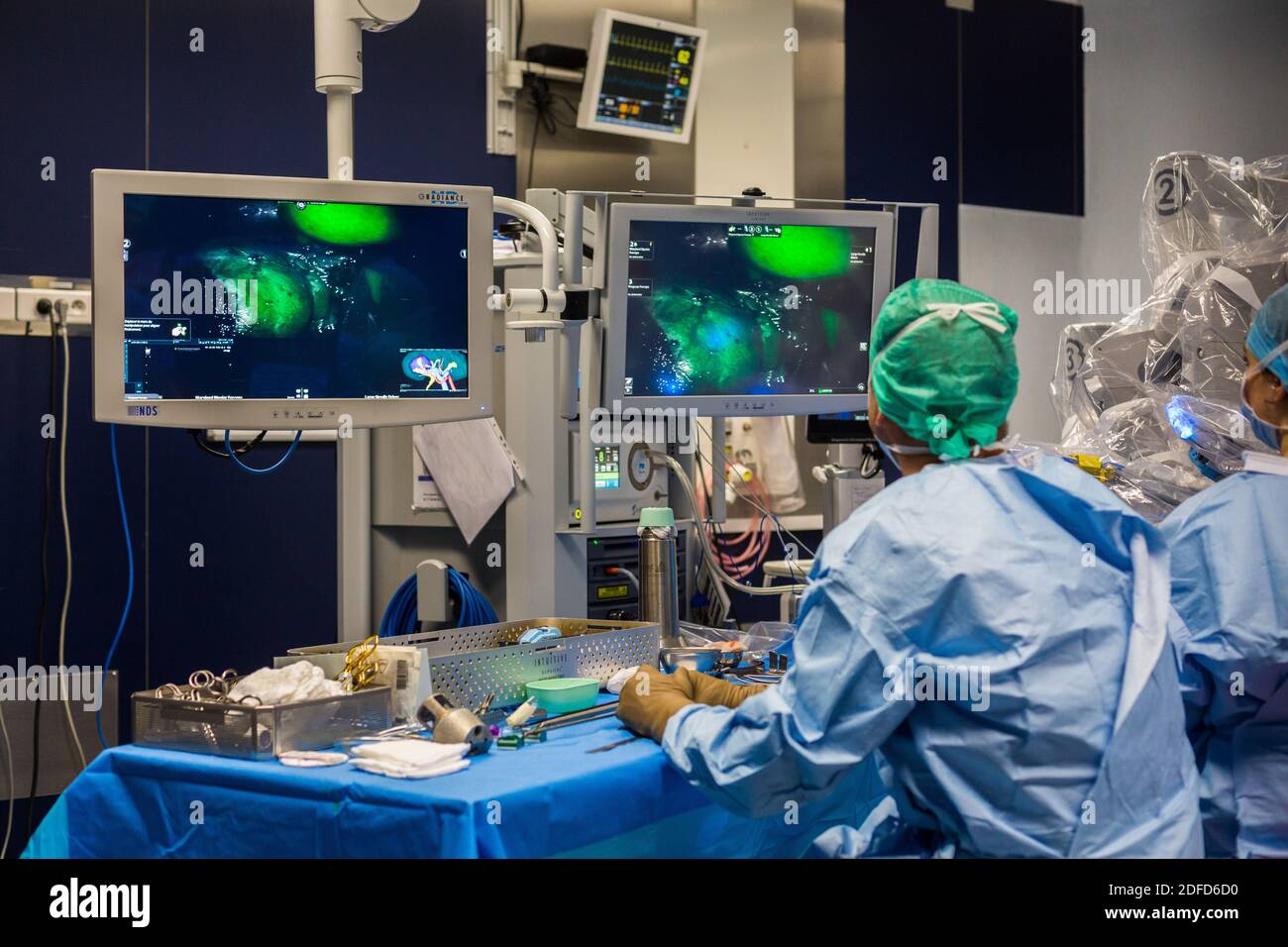 La chirurgie rénale conservatrice robotique guidée par l'image assistée par la modélisation 3D, cette modélisation 3D du rein avec sa tumeur située en violet, guide les s. Banque D'Images