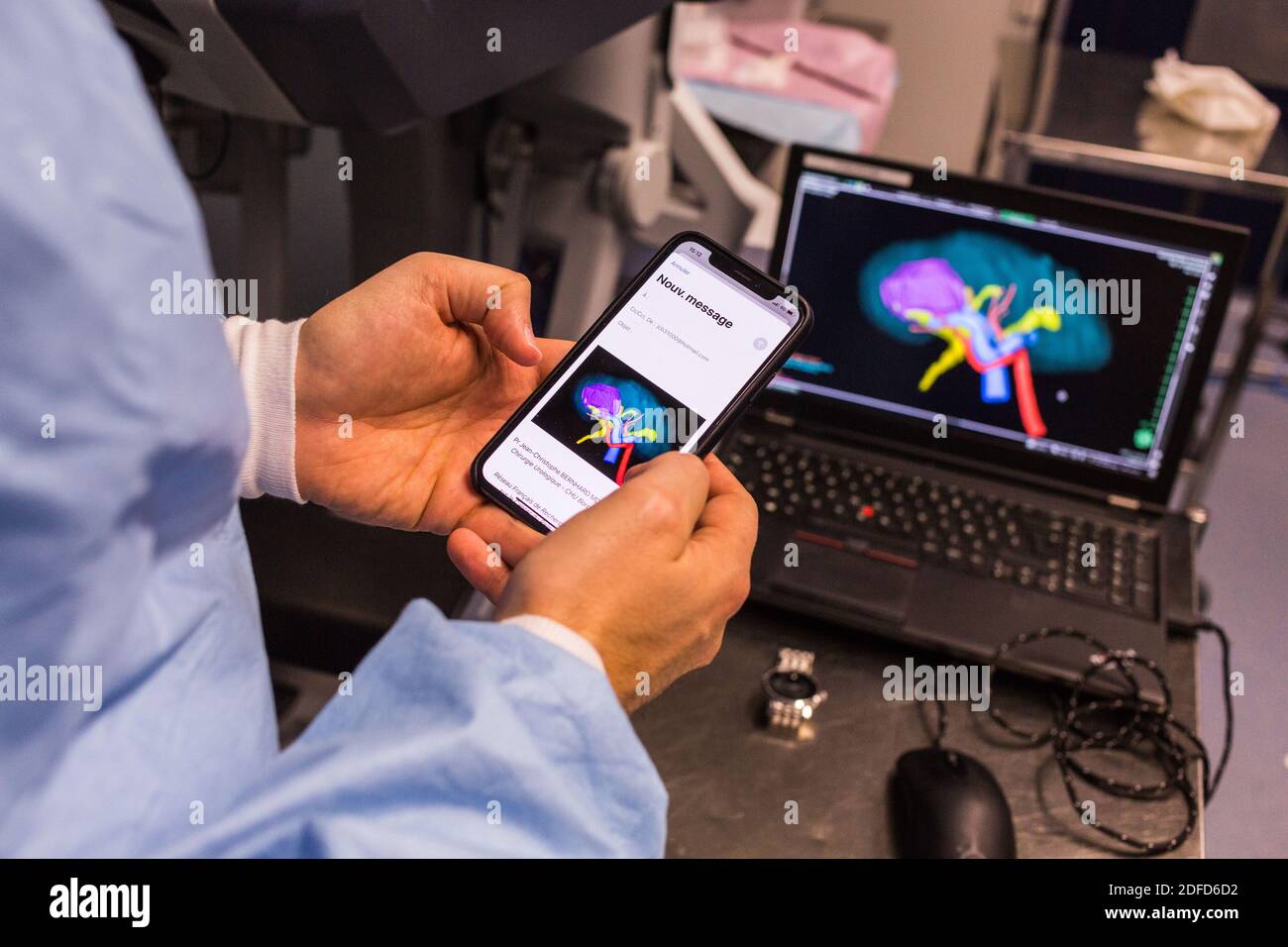 La chirurgie rénale conservatrice robotique guidée par l'image assistée par la modélisation 3D, cette modélisation 3D du rein avec sa tumeur située en violet, guide les s. Banque D'Images