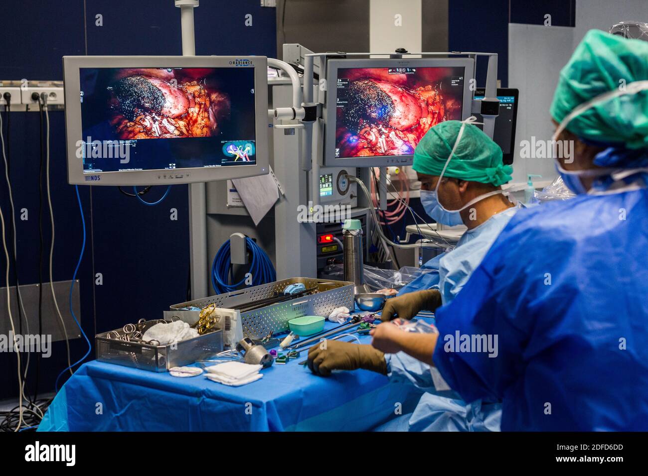 La chirurgie rénale conservatrice robotique guidée par l'image assistée par la modélisation 3D, cette modélisation 3D du rein avec sa tumeur située en violet, guide les s. Banque D'Images