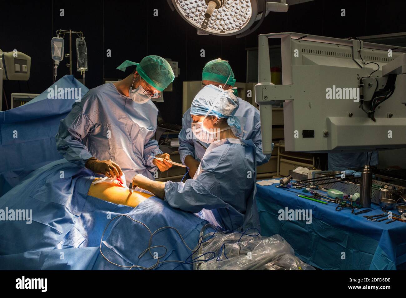 La chirurgie rénale conservatrice robotique guidée par l'image assistée par la modélisation 3D, cette modélisation 3D du rein avec sa tumeur située en violet, guide les s. Banque D'Images