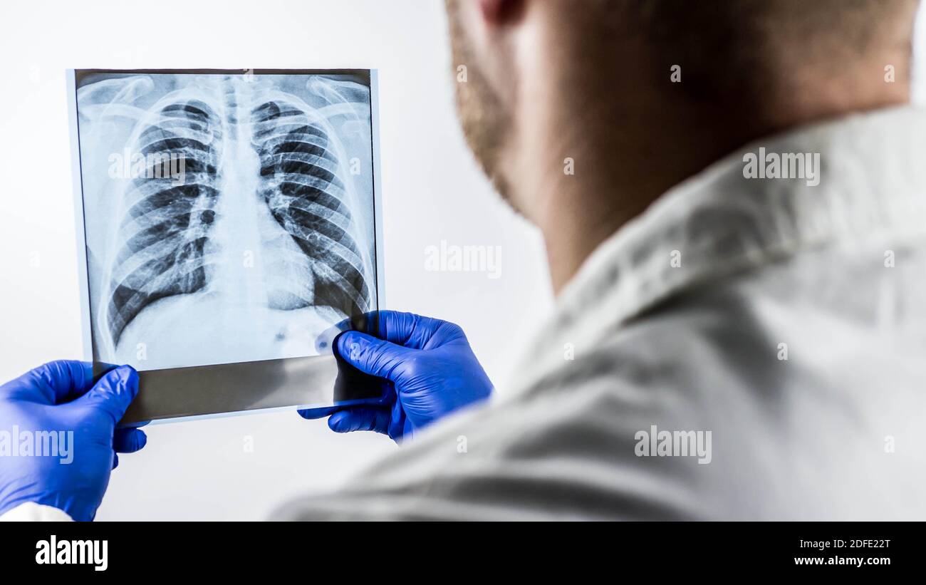 Un médecin tient une radiographie des poumons, fait un diagnostic, un travailleur médical fait une conclusion sur une radiographie. Banque D'Images